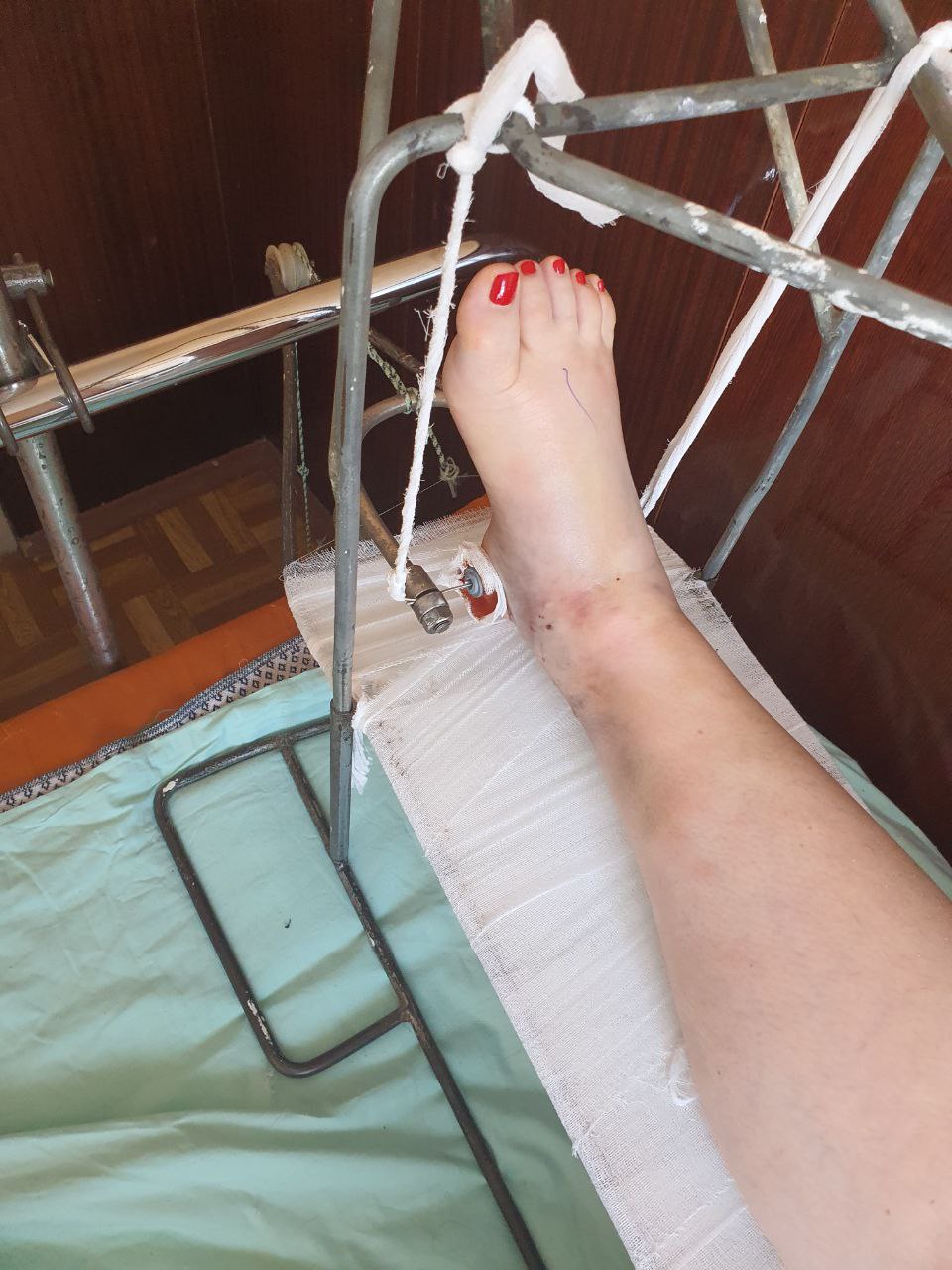 Руслана Писанка показала себя перед операцией: "может отвернуло от чего-то более страшного" (видео)